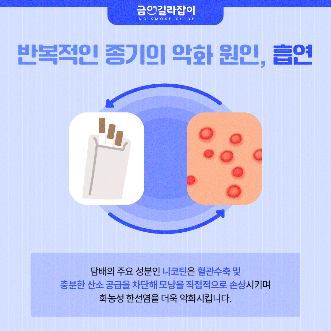 [카드뉴스] 화농성 한선염, 자꾸 생기는 종기 원인 흡연에도 있다 3
